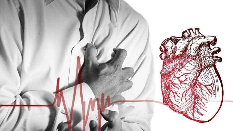 En raison de la perturbation du rythme cardiaque dans l'ostéochondrose thoracique, une extrasystole peut se développer. 