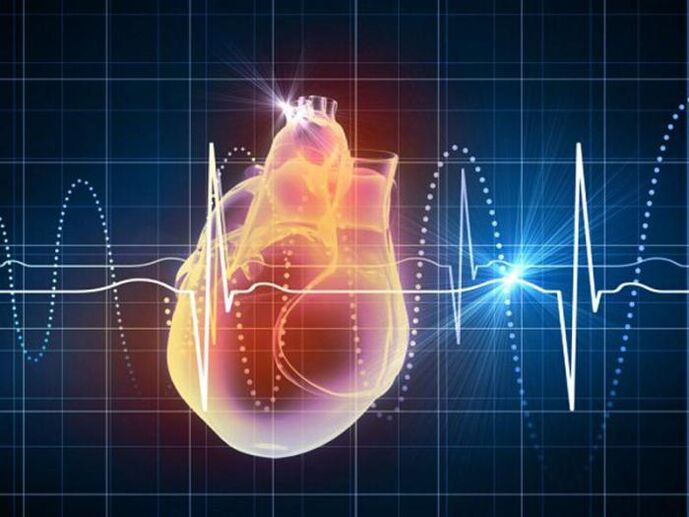 L'arythmie est une conséquence de l'ostéochondrose thoracique, qui se manifeste par une augmentation de la fréquence cardiaque. 