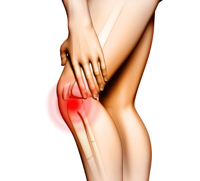 Étapes de l'arthrose